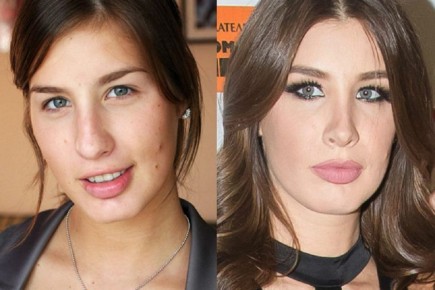 Пластика на пользу: как звезды преобразились после операций