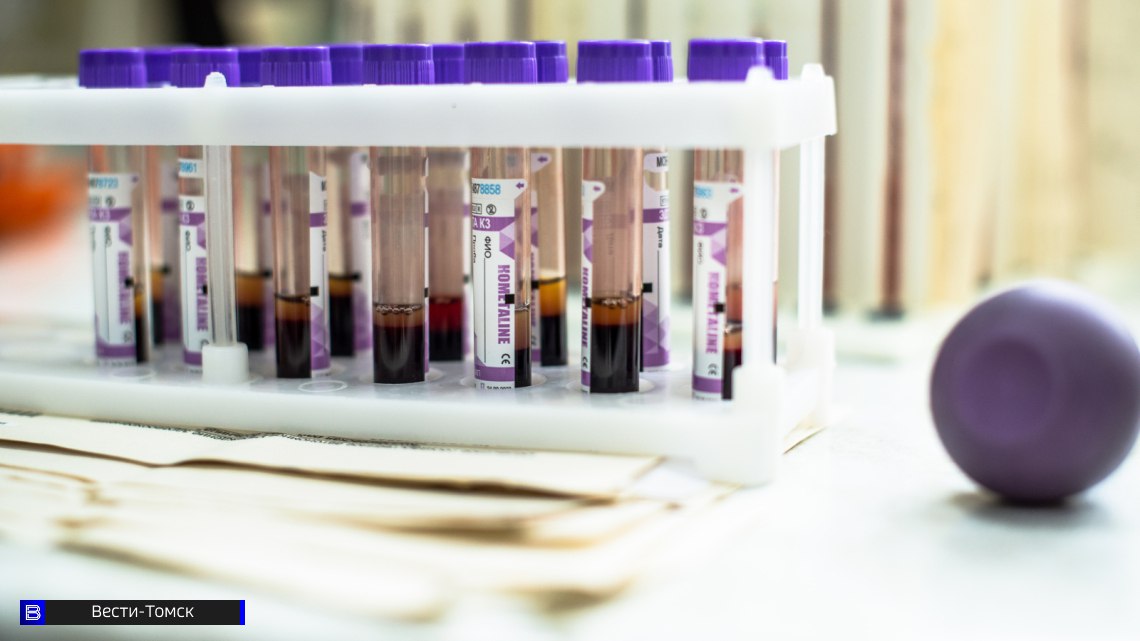 Более 300 случаев заражения ВИЧ выявлено в Томской области