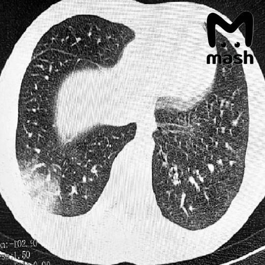 ����� ������� ��������� ��������� � ���������� ���������� ������� � ����������� �������� ����� � ������� ��������� ��-�� ����������� ������� ������