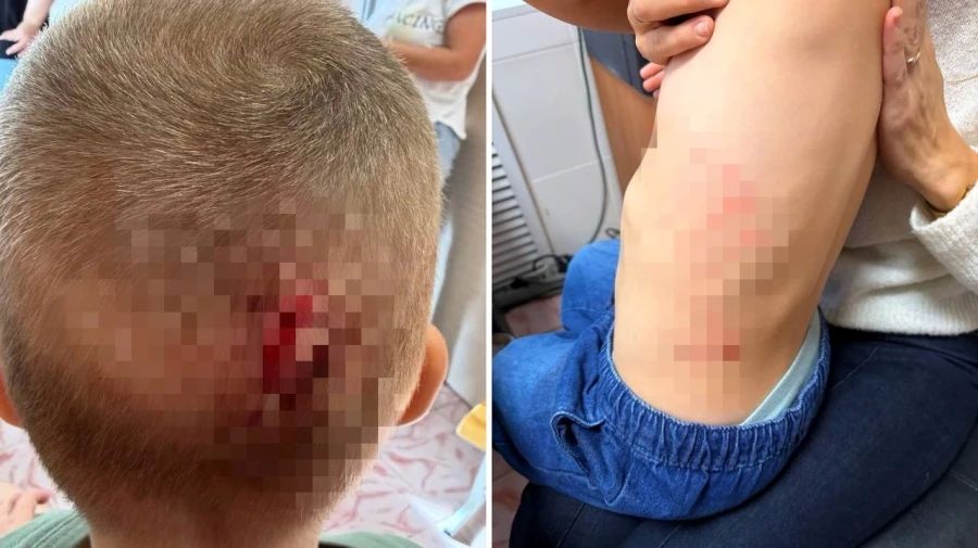 В Томске проводят проверку после падения двухъярусного шкафа на воспитанников детсада В Томске проводят проверку после падения двухъярусного шкафа на воспитанников детсада