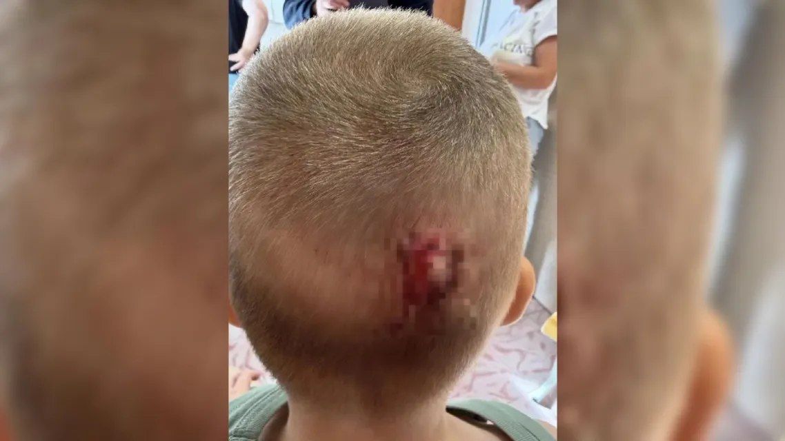 Стало известно состояние детей, пострадавших от падения шкафа в детсаду