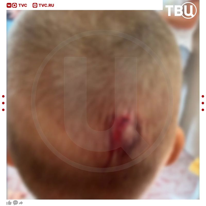 Дети получили травмы в детском саду Томска из-за падения шкафа