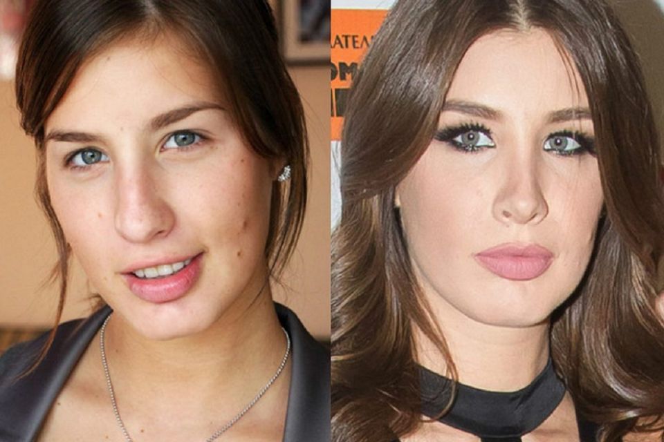 Пластика на пользу: как звезды преобразились после операций